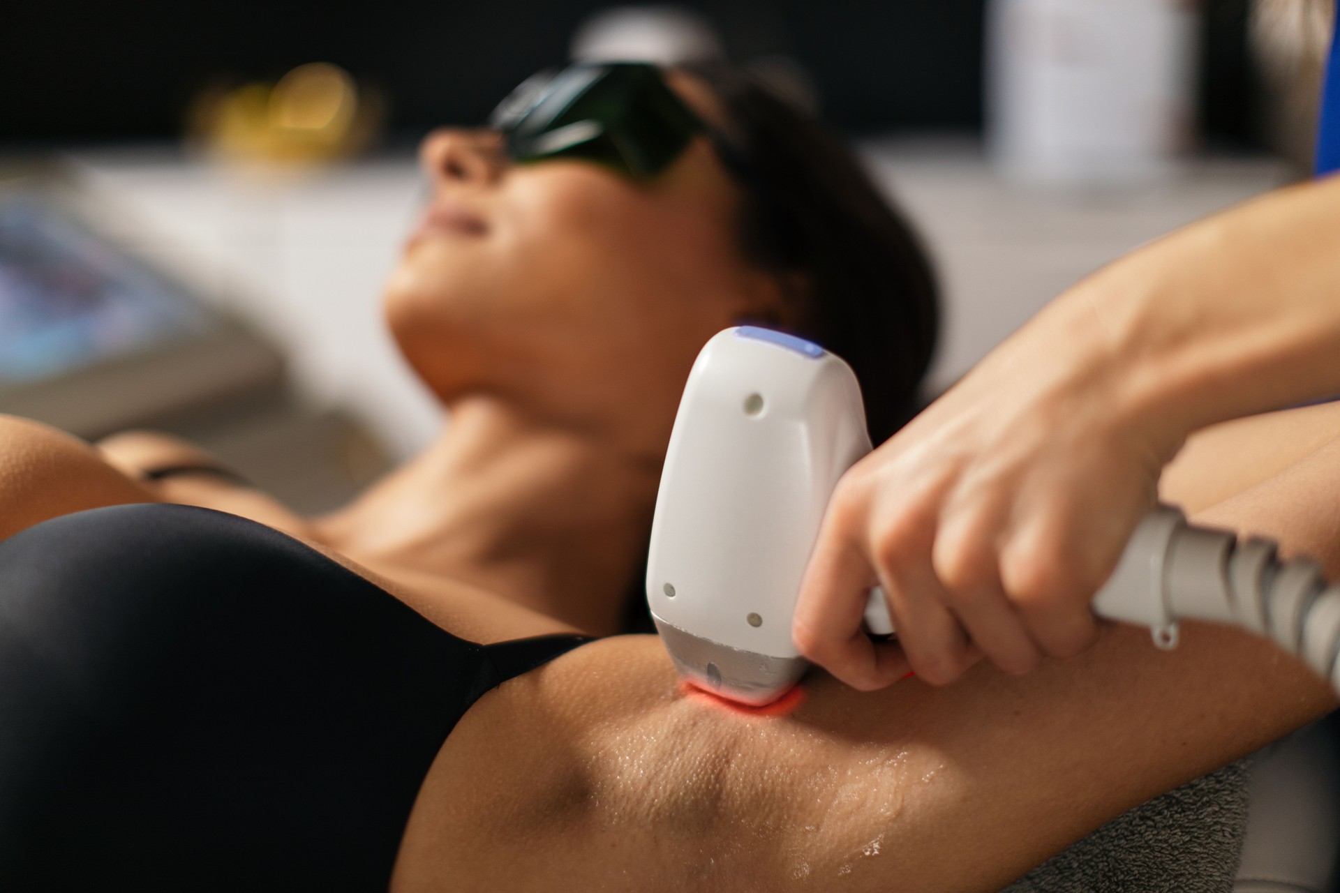 Laser epilation treatment. Body hair removal